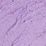 11 - LILAC